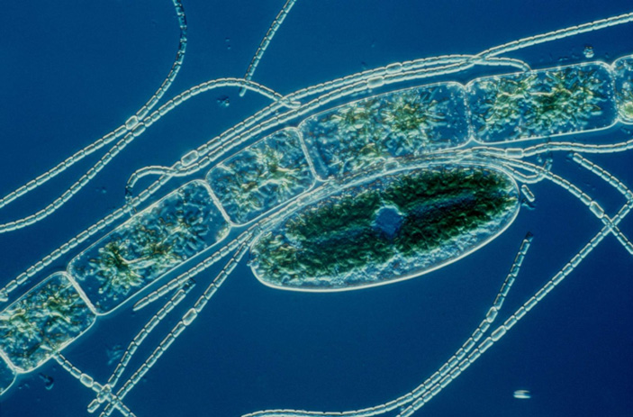1 — Anabaena sp. (цианобактерия), 2 — Zygnema sp. (зеленая водоросль с нитчатым талломом), 3 — Netrium (зеленая водоросль)