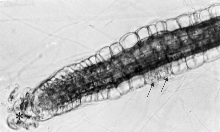 Рис. 8. Световая микрофотография молодого корня (Calluna vulgaris) с корневыми волосками