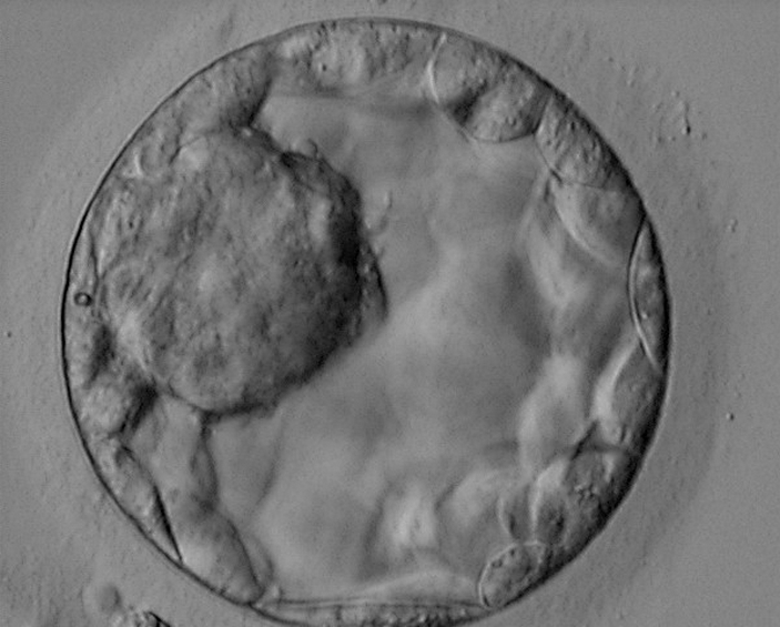 Бластоциста на 5-й день развития