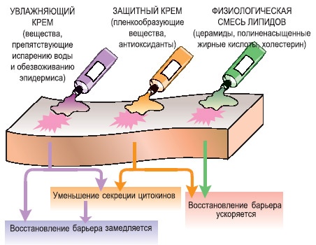 Стратегия восстановления кожного барьера включает увлажнение, защиту и питание. Однако пленкообразующие вещества, незаменимые в качестве средства «скорой помощи», при длительном применении оказывают обратное действие — восстановление рогового слоя замедляется