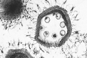 Рис. 6. Маленькие вирусы-спутники внутри гигантского мимивируса