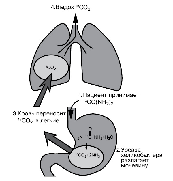 Рис. 1. Уреазный дыхательный тест — «золотой стандарт» диагностики Helicobacter pylori. Ее фермент уреаза разлагает мочевину до СО2 и аммиака. Процесс протекает в четыре этапа, показанных на рисунке