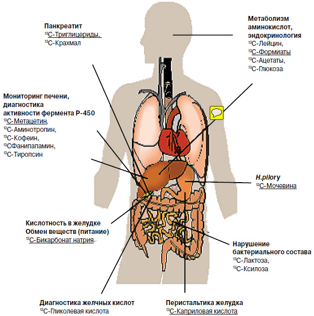<b>Рис. 3.</b> Примеры диагностических тестов с помощью препаратов, меченных изотопом <sup>13</sup>С. Подчеркнуты первые российские препараты (сейчас их около 20)