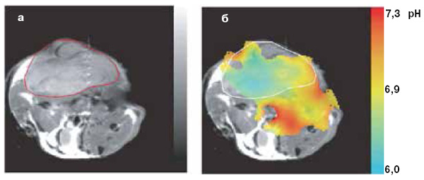 <b>Рис. 5.</b> Обнаружение опухоли (лимфомы) у мыши с помощью <sup>13</sup>С-ЯМР и <sup>13</sup>С-биомаркеров: <br>\n<b>а</b> — изображение лимфомы, привитой мыши; <br>\n<b>б</b> — опухоль повышает кислотность среды и может быть обнаружена с помощью <sup>13</sup>С-бикарбоната натрия (NaH<sup>13</sup>CO<sub>3</sub>)