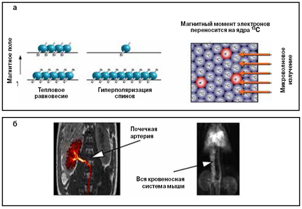 Рис. 6. 13С-томография (13С-МРТ) с помощью гиперполяризации 13С-биомаркеров