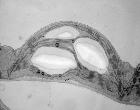 Хлоропласт (электронная микроскопия)