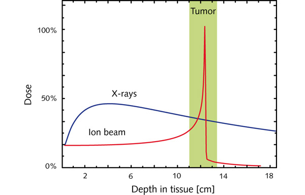 Рис. 3. Доза, получаемая тканями при облучении рентгеновскими лучами и пучком ионов. Идея лучевой терапии рака основана на повышенной чувствительности опухолей к радиации. Чтобы облучить опухоль, лежащую внутри тела пациента, необходимо использовать рентгеновское излучение с достаточно высокой проникающей способностью. Но такое излучение неизбежно создаст значительную дозу и в окружающих здоровых тканях. Напротив, пучок протонов (а еще лучше — многозарядных тяжелых ионов) создаст наибольшую ионизацию в брэгговском пике, который подходящим выбором начальной энергии можно поместить на глубину залегания опухоли (отмечена на рисунке зеленой полосой). Чтобы еще уменьшить дозовую нагрузку на здоровые ткани, можно облучать опухоль несколькими пучками с разных направлений. Изображение с сайта www.gsi.de