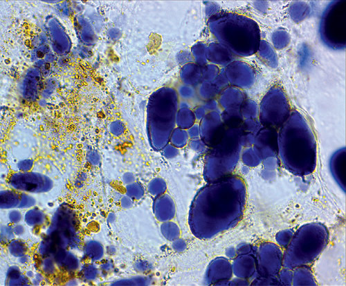 Картофель. Синие пятна — зёрна крахмала. Увеличение 100×. Окраска йодом.