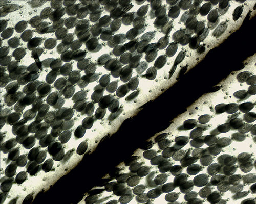 Крыло бабочки боярышницы. Увеличение 100×