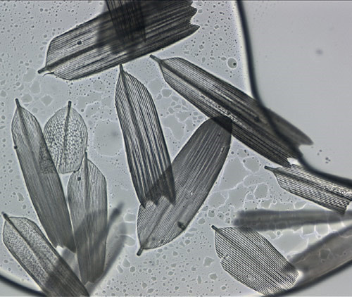 Чешуйки с крыльев моли. Увеличение 400×