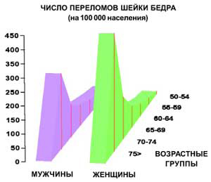 Наиболее распространенная причина инвалидности при остеопорозе как у мужчин, так и у женщин — перелом шейки бедра (изображение: «Наука и жизнь»)