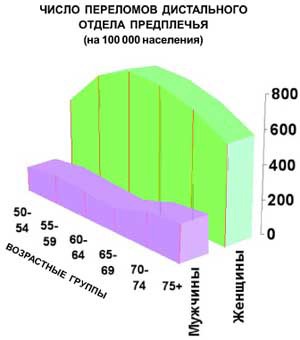 Перелом предплечья при остеопорозе случается преимущественно у женщин пожилого возраста (изображение: «Наука и жизнь»)