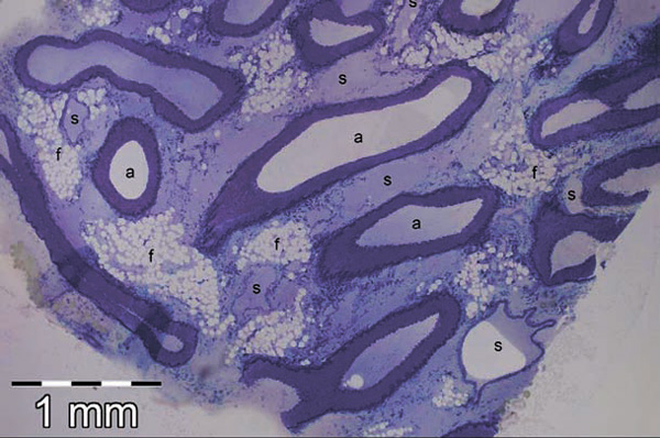 Рис. 1. Поперечный срез через часть грудной артериальной сети. На нем видны артерии (А) и тонкостенные синусоиды (S), утопленные в жир (F)