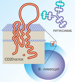 Под воздействием ритуксимаба вырабатываемый В-лимфоцитом цитокин CD20 не может высвободиться с его мембраны и поддержать воспалительный процесс. Изображение: «Наука и жизнь»