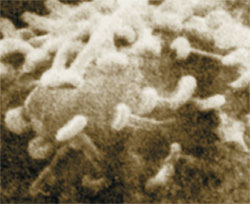 Микрофотография нейрона, плотно упакованного синапсами. Фото: «Наука и жизнь»