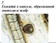Глохидии в капсуле, образованной эпителием жабр