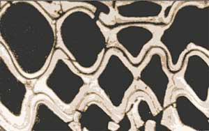 Фото 2. Слоистое строение оболочки клетки. Черный слой — первичная оболочка, темно-серый — вторичная оболочка. Различие в оттенках свидетельствует о разной степени распыления вещества: в первичной оболочке она выше, чем во вторичной (увеличение 830x). Черные пятна внутри клеток —полости, заполненные воздухом. Изображение: «Наука и жизнь»