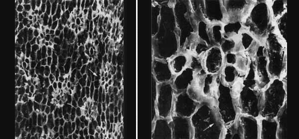 Рис. 2. Полиморфизм устьичных аппаратов у пермского хвойного Ullmannia cf. bronnii Goeppert. Абортированный устьичный аппарат (стрелка) в виде скопления мелких мезогенных клеток, образующих в зрелом мезоперигенном аппарате (справа) кольцо побочных клеток, прерванное вклинивающейся перигенной клеткой. Изображение «Экология и жизнь»