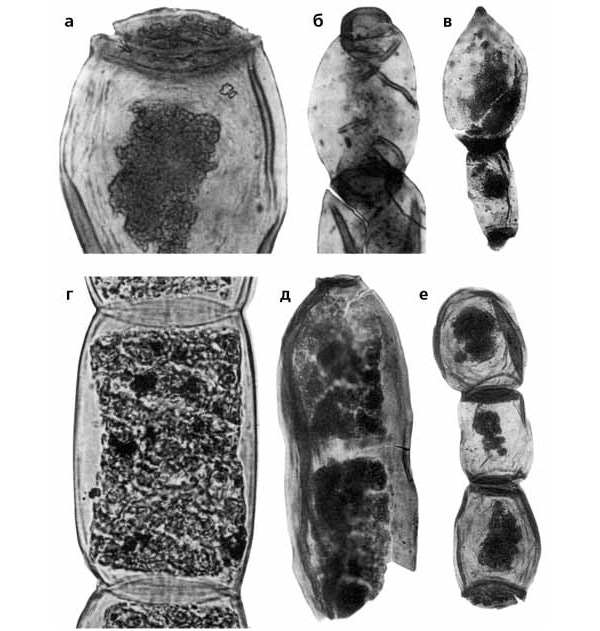 Рис. 5. Tympanicysta из пограничных отложений перми и триаса Русской платформы. Колонии вегетативных клеток и акинеты (слева внизу для сравнения фрагмент нитчатой колонии современной водоросли Spirogyra sp.). Длина масштабной линейки: а, б, г, д — 10 мкм; в — 20 мкм; е — 30 мкм. Изображение «Экология и жизнь»