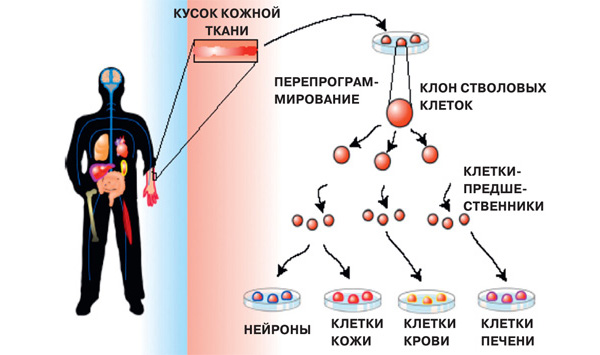 Исследователи научились перепрограммировать обычные клетки из кожи пациента c помощью специальных веществ (факторов транскрипции) в индуцированные стволовые (плюрипотентные) клетки. Полученные культуры стволовых клеток пациента можно направить по пути превращения в клетки-предшественники и дальнейшей специализации в различные аутологичные клетки и ткани: нейроны, ткани кожного покрова, клетки крови и печени. По оценке специалистов, данные технологии будут доступны для клинического применения через три-пять лет, а для эксклюзивного использования — через полтора-два года.