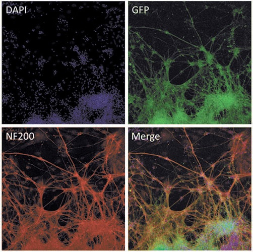 ЭС-клетки с генетически модифицированным геномом. Свечение EGFP под контролем эндогенного промотора маркера нейронов, бета-тубулина класса III (зеленый); окраска антителами на белок NF200, маркер нейронов (красный); окраска ДНК с помощью DAPI (синий)