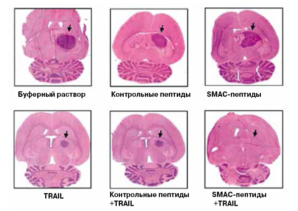 <b>Рис. 3.</b> Подобные SMAC вещества (пептиды или низкомолекулярные органические соединения) делают злокачественную опухоль мозга — глиому чувствительной к терапии белком TRAIL, цитокином из семейства факторов некроза опухолей, а также к многим химиотерапевтическим препаратам (не указаны на рисунке). Только при их совместном действии глиома в мозге подопытных мышей исчезает полностью, ее клетки гибнут по пути апоптоза (S.Fulda et al, <i>Nature Medicine</i>, 2002, 8 (8), 808–815, DOI:<a href=/"http://www.nature.com/nm/journal/v8/n8/full/nm735.html" target=_blank>10.1038/nm735</a>). В настоящее время данные миметики SMAC находятся на третьей фазе клинических испытаний