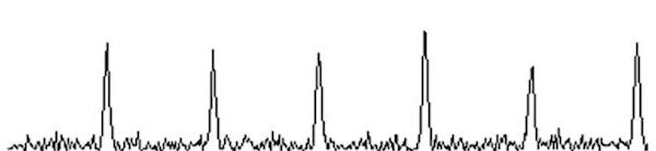 Типичные сигналы радиопульсара