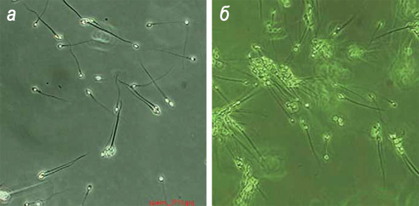 Cперматозоиды человека перед отбором для искусственного оплодотворения («Наука из первых рук» №2(62), 2015)