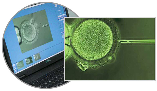 При методике ИКСИ яйцеклетку оплодотворяет путем инъекции в нее единственного сперматозоида («Наука из первых рук» №2(62), 2015)