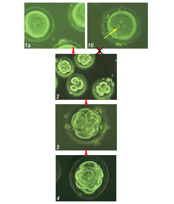 Развитие эмбриона после искусственного оплодотворения («Наука из первых рук» №2(62), 2015)