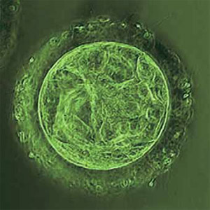 Эмбрион человека на 5-е сутки после классического ЭКО («Наука из первых рук» №2(62), 2015)