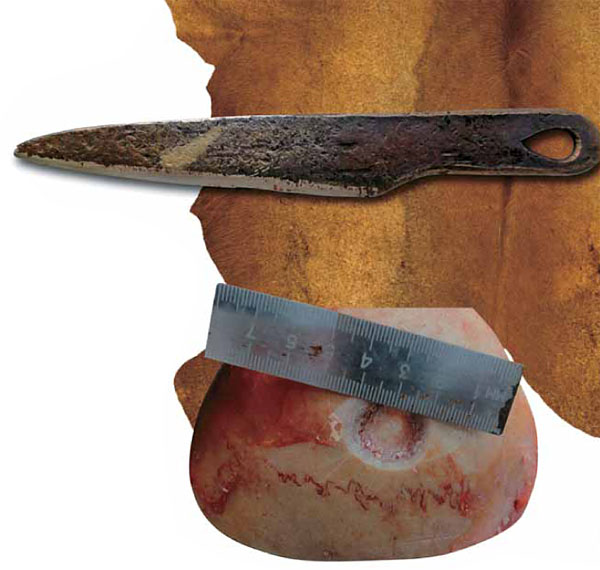 Экспериментальная трепанация на черепе трупа, выполненная ножом, который был изготовлен по древним образцам («Наука из первых рук» №5/6(65/66), 2015)