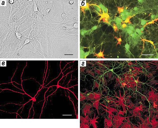 Нейронная сеть первичной культуры гиппокампа эмбрионов мышей («Природа» №6, 2015)