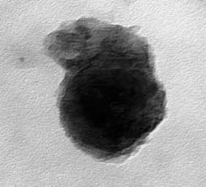 Рис. 4. Экзосома с аморфным фосфатом кальция («Химия и жизнь» №6, 2016)