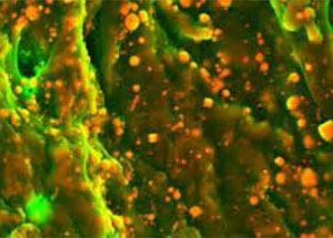 Рис. 5. «Камешки» в стенке аорты человека («Химия и жизнь» №6, 2016)