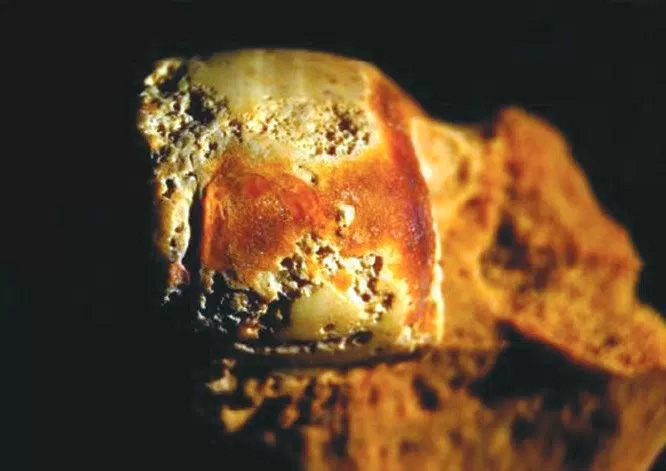 Следы остеоартрита на среднем мыщелке женской бедренной кости (Austin, 2016) (ТрВ №1(220), 17 января 2017 г.)