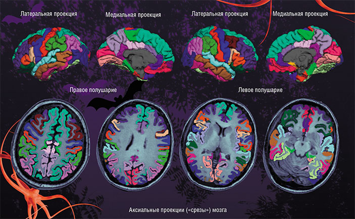 Визуализация различных отделов коры двух полушарий головного мозга у пациента с депрессией («Наука из первых рук» №1(73), 2017)