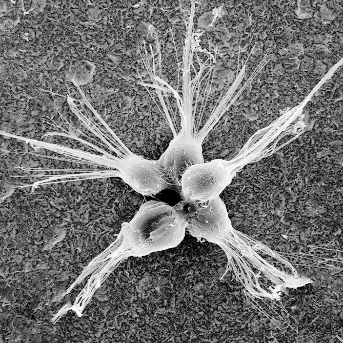 Рис. 2. Колонии-розетки Salpingoеca rosetta (изображение instruct.uwo.ca)