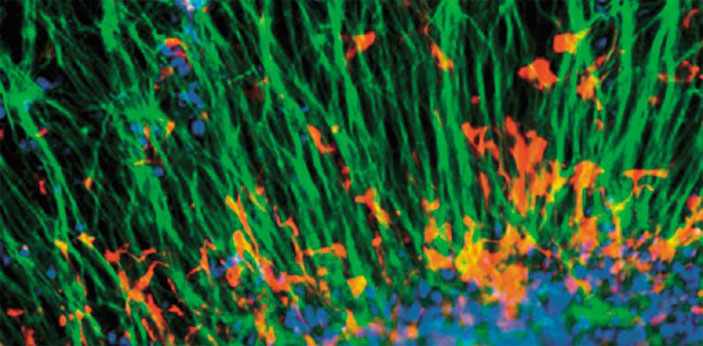 Нейральные клетки, дифференцированные из ИПСК и помеченные красителями («Наука из первых рук» №4 (75), 2017)