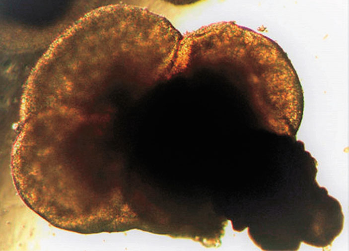 Так называемый «органоид» мозга, полученный из индуцированных плюрипотентных стволовых клеток (ИПСК) («Наука из первых рук» №4 (75), 2017)