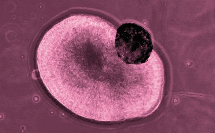 Органоид глаза, дифференцированный из ИПСК («Наука из первых рук» №4 (75), 2017)