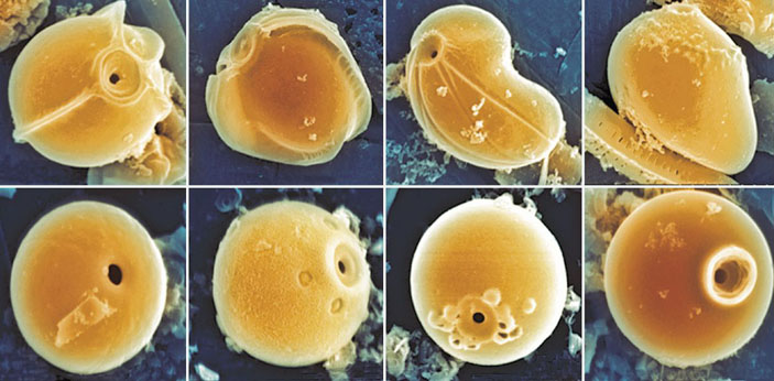 Стоматоцисты золотистых водорослей («Наука из первых рук» №4(52), 2013)