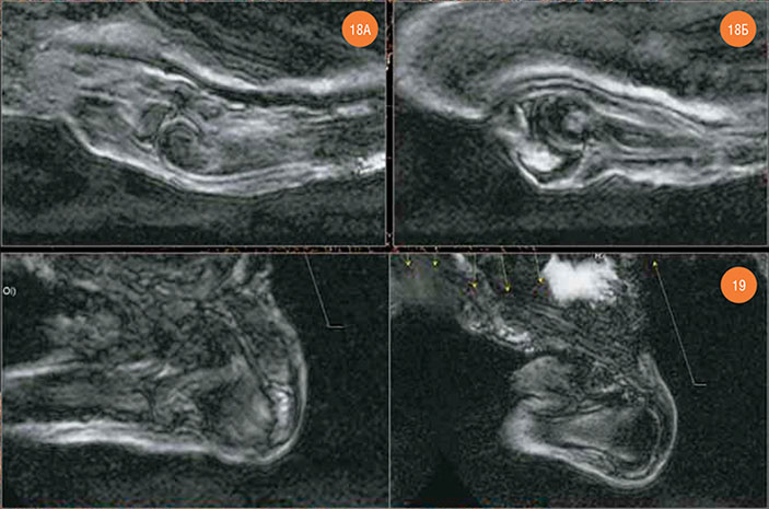 МР-томограммы мумии «Алтайской принцессы» («Наука из первых рук» №3/4(57/58), 2014)