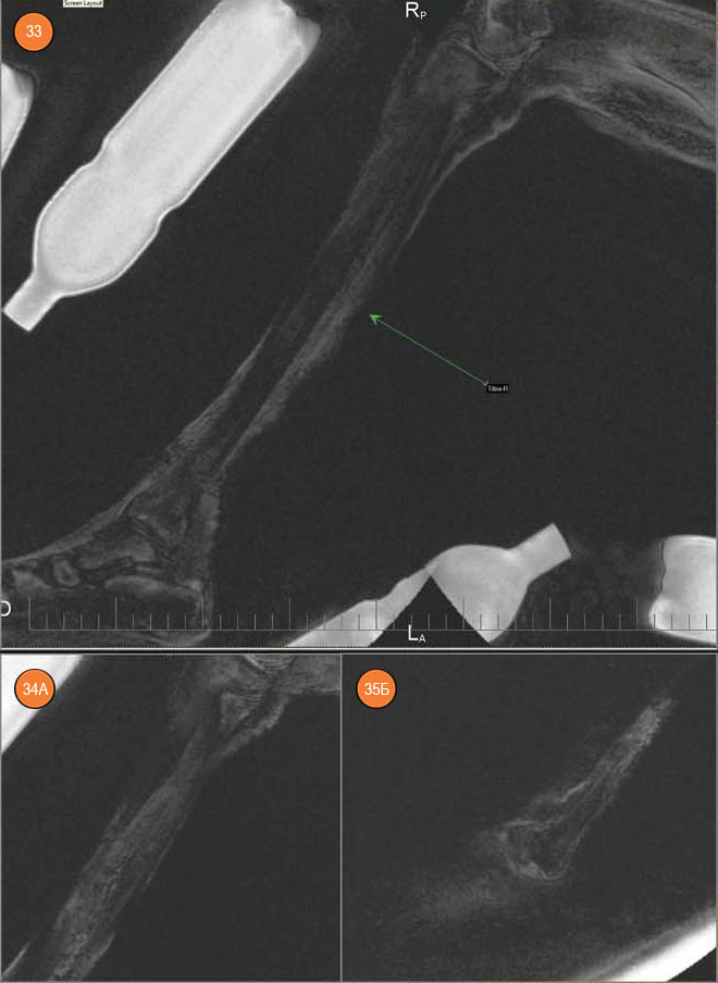МР-томограммы мумии «Алтайской принцессы» («Наука из первых рук» №3/4(57/58), 2014)
