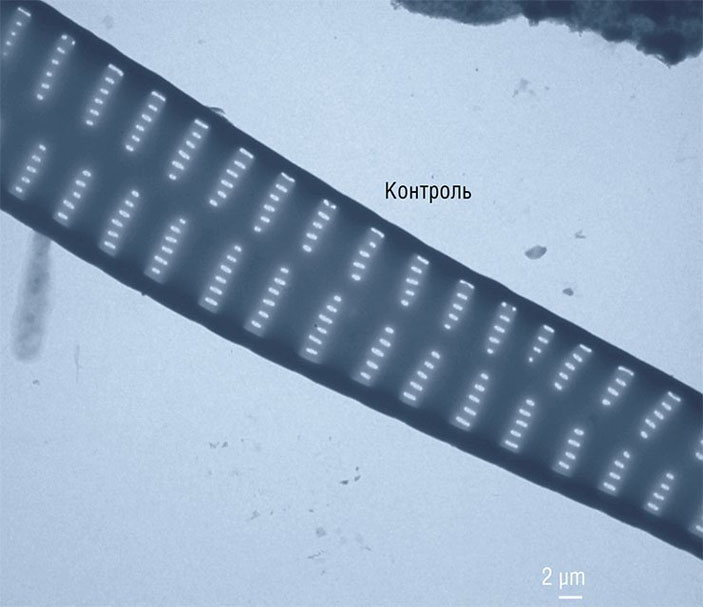 Synedra acus, контроль («Наука из первых рук» №2(68), 2016)