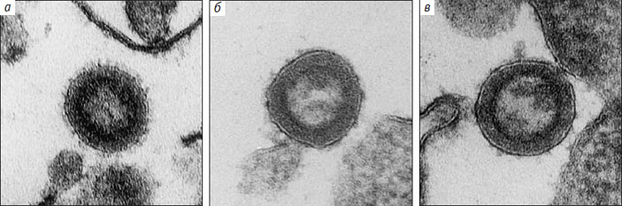 Рис. 2. Микрофотографии тонких срезов зараженных фиксированных клеток, окрашенных дубильной кислотой для визуализации шипов Env с различной длиной цитоплазматического домена («Природа» №10, 2018)