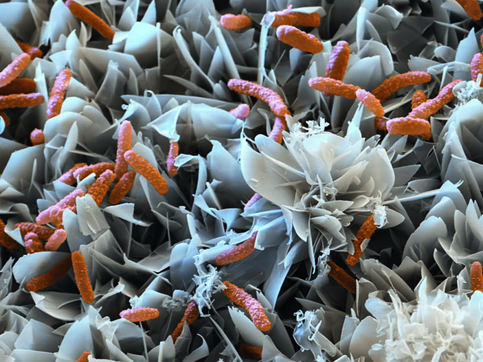 Бактерии ацидоворакс стимулируют образование зеленой ржавчины — гидроксида железа («Популярная механика» №11, 2019)