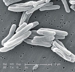 Бактерия, вызывающая туберкулёз (Mycobacterium tuberculosis) («Наука и жизнь» №11, 2019)