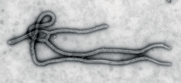 Возбудитель лихорадки Эбола («Наука и жизнь» №11, 2019)