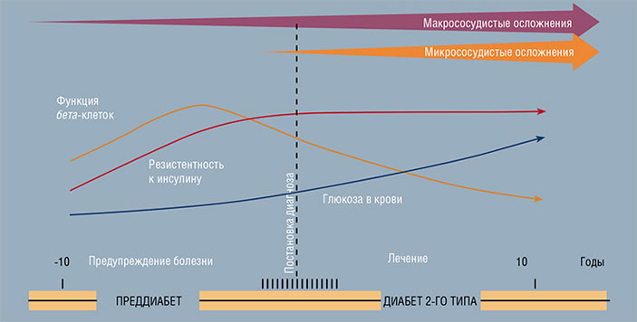 Стадии прогрессирования сахарного диабета 2-го типа («Наука из первых рук» №2, 2020)
